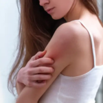 A Complete Guide to Managing Atopic Dermatitis